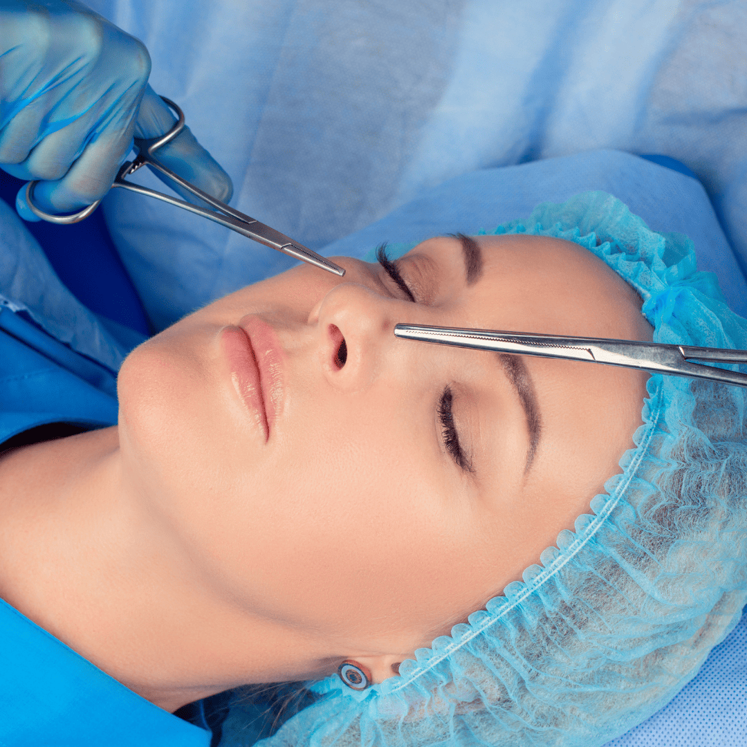 rhinoplastie
